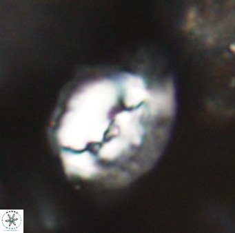 Helicosphaerella bipuncta VR 32998
