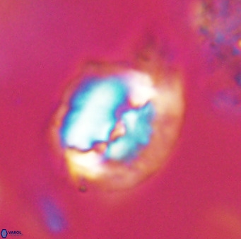 Helicosphaerella bipuncta VR 32999