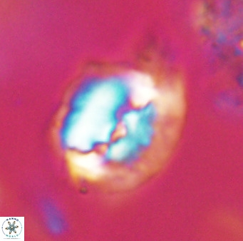 Helicosphaerella bipuncta VR 32999