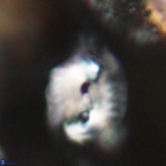 Helicosphaerella bipuncta VR 32990