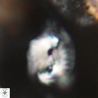 Helicosphaerella bipuncta VR 32990