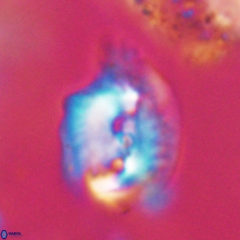 Helicosphaerella bipuncta VR 32991