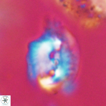 Helicosphaerella bipuncta VR 32991