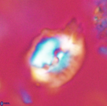 Helicosphaerella bipuncta VR 32992