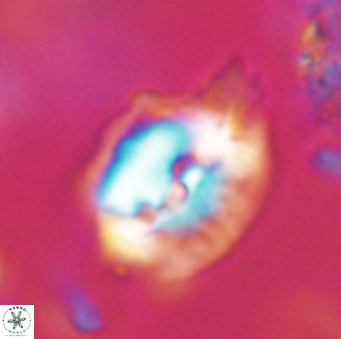 Helicosphaerella bipuncta VR 32992