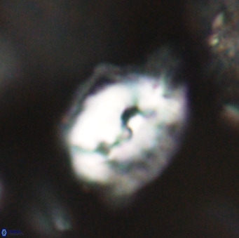 Helicosphaerella bipuncta VR 32993