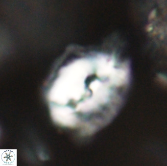 Helicosphaerella bipuncta VR 32993