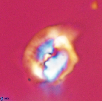 Helicosphaerella bipuncta VR 33004