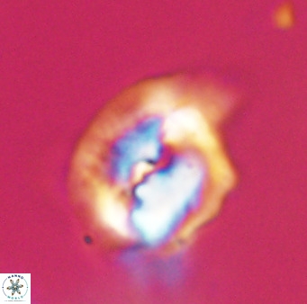 Helicosphaerella bipuncta VR 33004