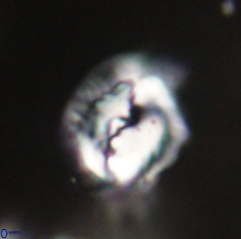 Helicosphaerella bipuncta VR 33005