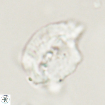 Helicosphaerella bipuncta VR 33006