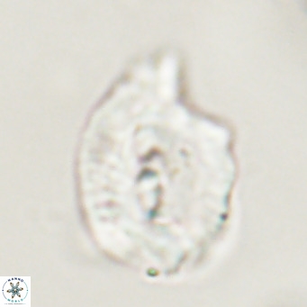 Helicosphaerella bipuncta VR 33007