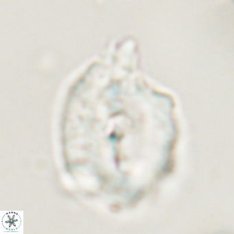 Helicosphaerella bipuncta VR 33008