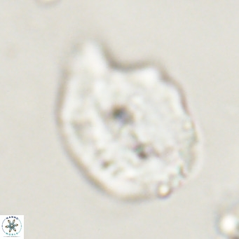 Helicosphaerella bipuncta VR 33009