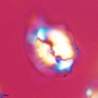 Helicosphaerella bipuncta VR 33000