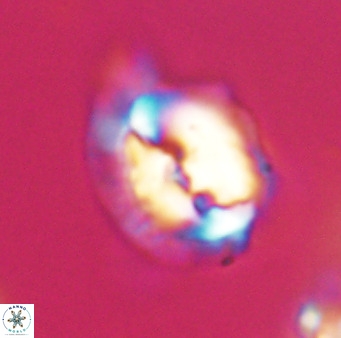Helicosphaerella bipuncta VR 33000