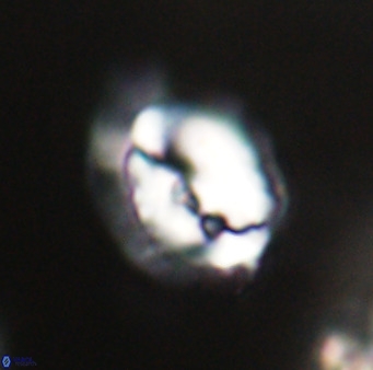 Helicosphaerella bipuncta VR 33001