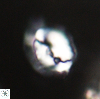 Helicosphaerella bipuncta VR 33001