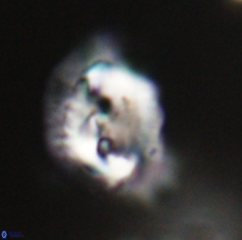 Helicosphaerella bipuncta VR 33002