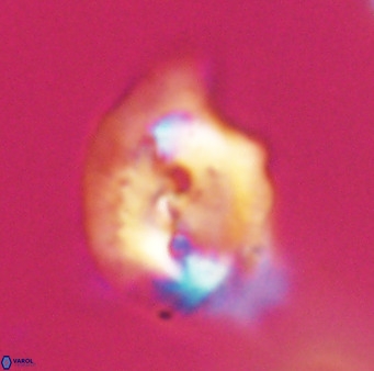 Helicosphaerella bipuncta VR 33003