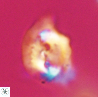 Helicosphaerella bipuncta VR 33003