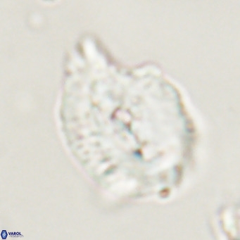 Helicosphaerella bipuncta VR 33010