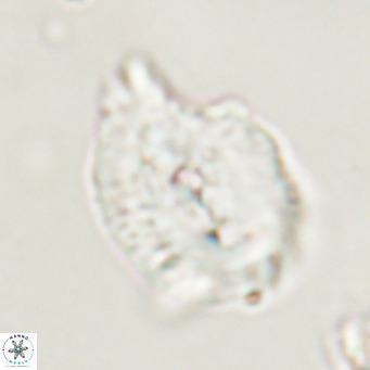 Helicosphaerella bipuncta VR 33010