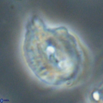 Helicosphaerella bipuncta VR 33011