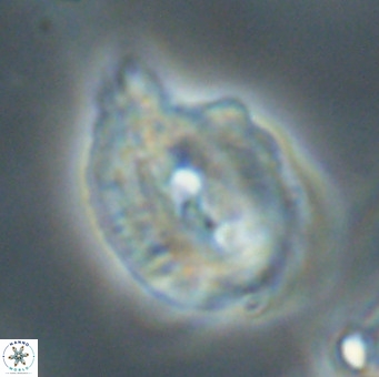 Helicosphaerella bipuncta VR 33011