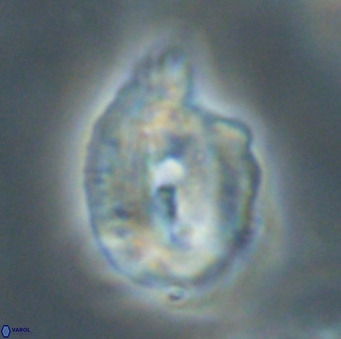 Helicosphaerella bipuncta VR 33012