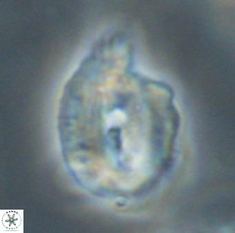 Helicosphaerella bipuncta VR 33012