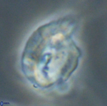 Helicosphaerella bipuncta VR 33013