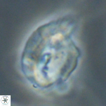 Helicosphaerella bipuncta VR 33013