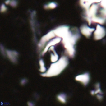 Helicosphaerella bramlettei VR 027214
