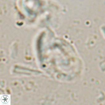 Helicosphaerella bramlettei VR 027218