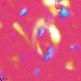 Helicosphaerella bramlettei VR 027211