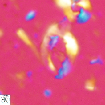 Helicosphaerella bramlettei VR 027211