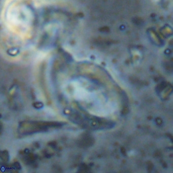 Helicosphaerella bramlettei VR 027224