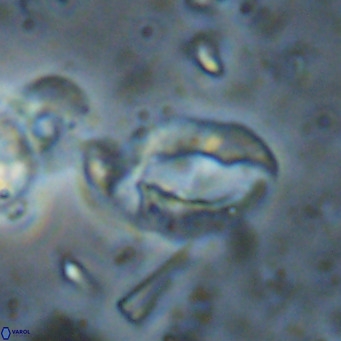 Helicosphaerella bramlettei VR 027225