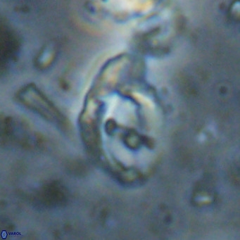 Helicosphaerella bramlettei VR 027223