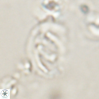 Helicosphaerella bramlettei VR 028435