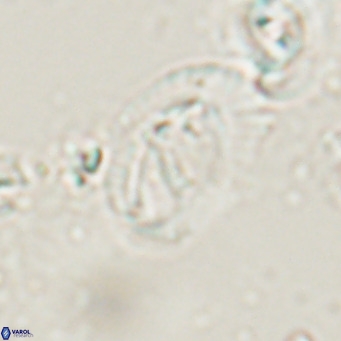 Helicosphaerella bramlettei VR 028437
