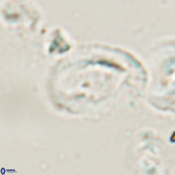 Helicosphaerella bramlettei VR 028438