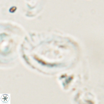 Helicosphaerella bramlettei VR 028433
