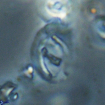 Helicosphaerella bramlettei VR 028443