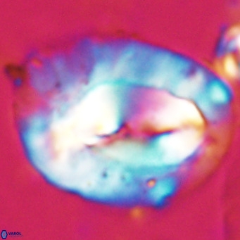 Helicosphaerella compacta VR 027541