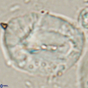 Helicosphaerella compacta VR 027543