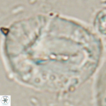 Helicosphaerella compacta VR 027543