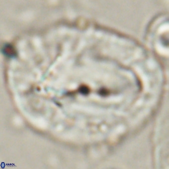 Helicosphaerella compacta VR 027544