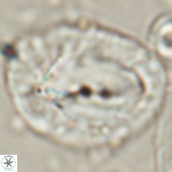 Helicosphaerella compacta VR 027544